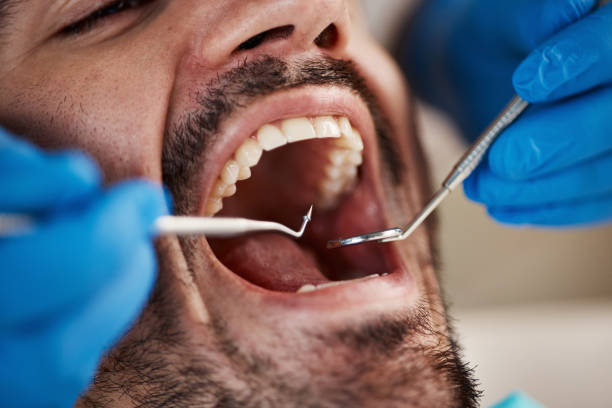 Best Pediatric Emergency Dentist in Granville, WV